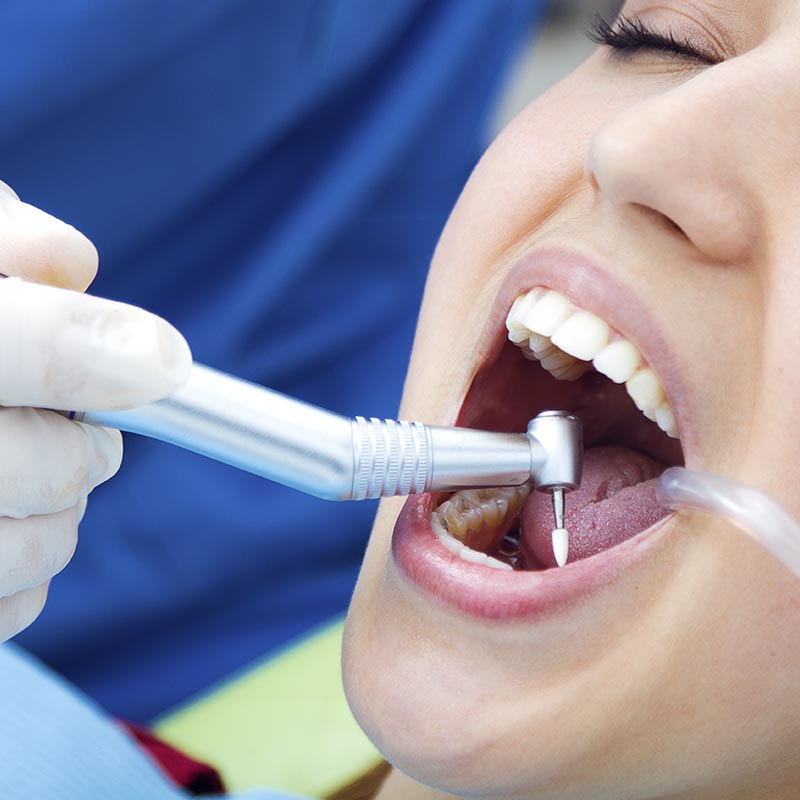 dentista caries plasencia